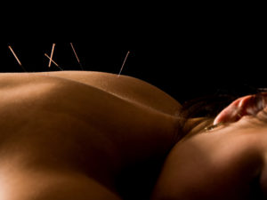 Acupuncture Cedar Park, TX