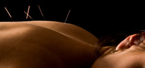 Acupuncture in Cedar Park, TX